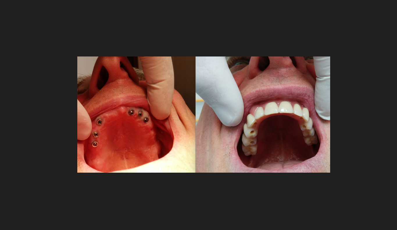 Implantologia e Chirurgia Orale