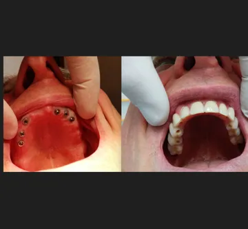 Implantologia e Chirurgia Orale