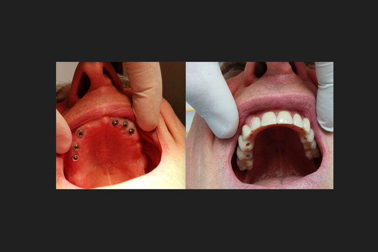 Implantologia e Chirurgia Orale